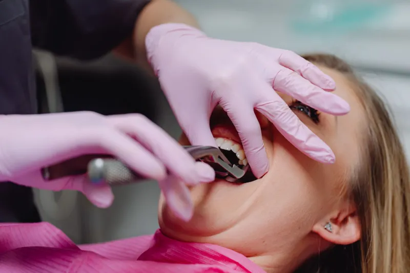A dentist extracting a tooth during minor oral surgery