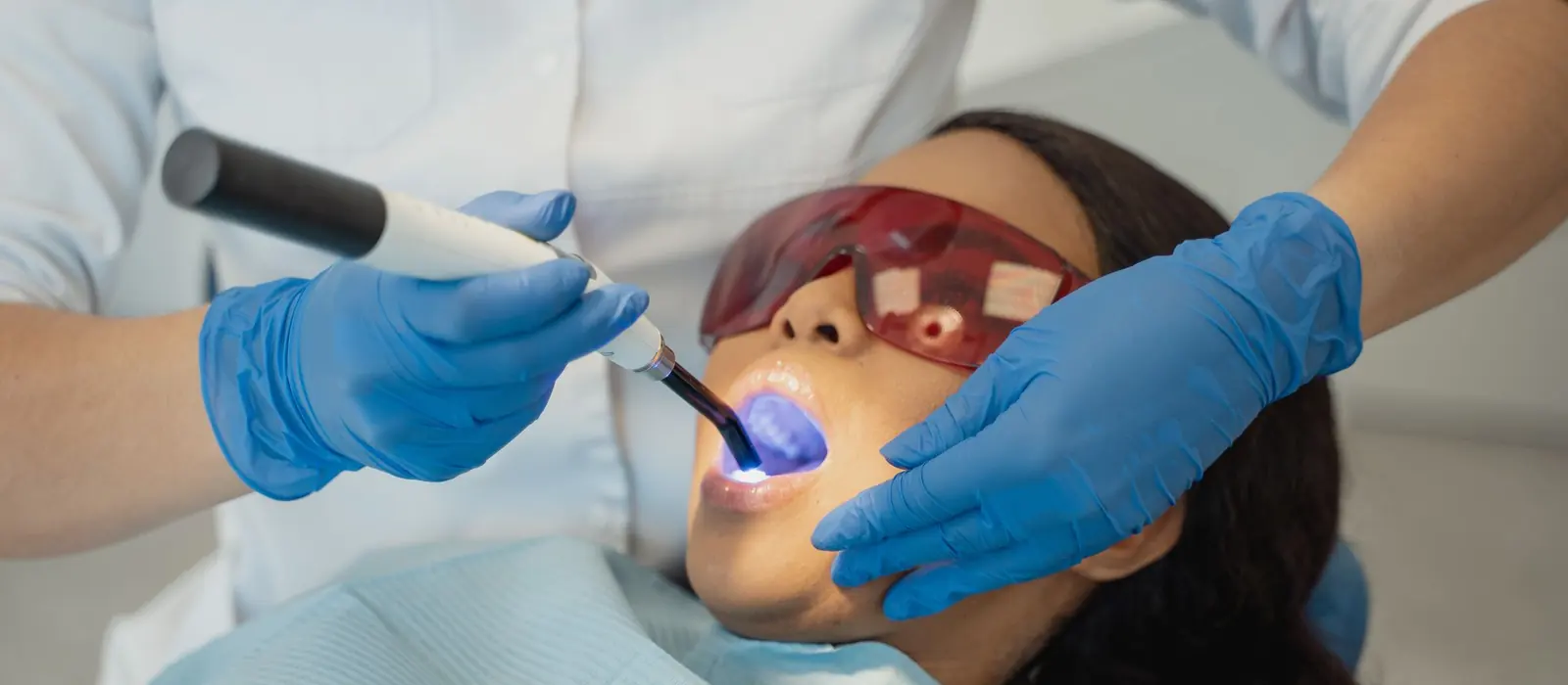 A dentist setting a tooth-coloured filling with a blue curing light